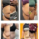 before and after photo gallery